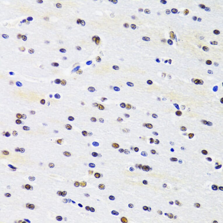 Immunohistochemistry - Anti-PRPF3 Antibody (A14795) - Antibodies.com