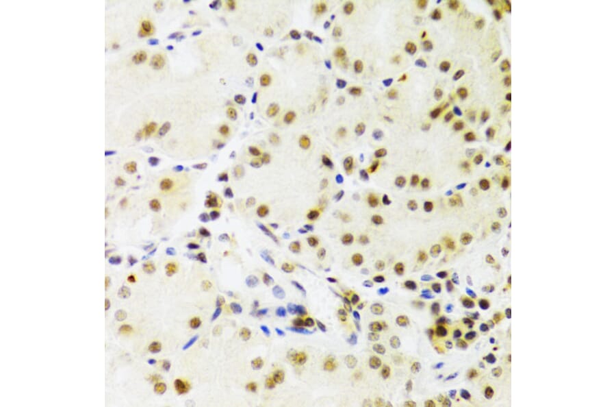 Immunohistochemistry - Anti-PRPF3 Antibody (A14795) - Antibodies.com