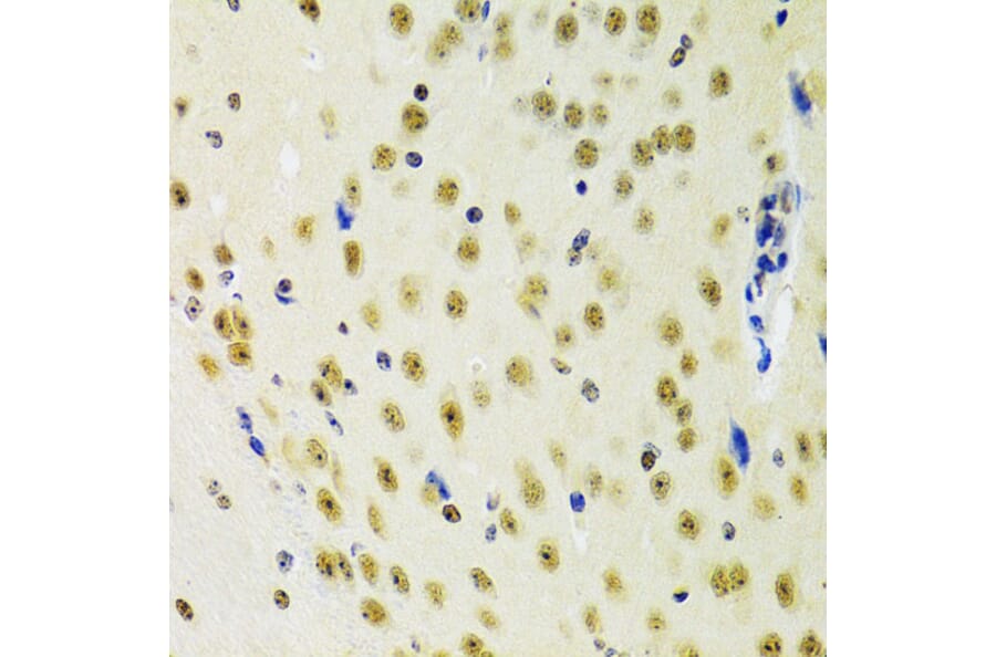 Immunohistochemistry - Anti-PRPF3 Antibody (A14795) - Antibodies.com