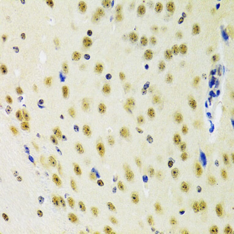 Immunohistochemistry - Anti-PRPF3 Antibody (A14795) - Antibodies.com