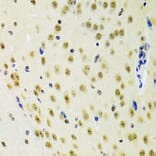 Immunohistochemistry - Anti-PRPF3 Antibody (A14795) - Antibodies.com