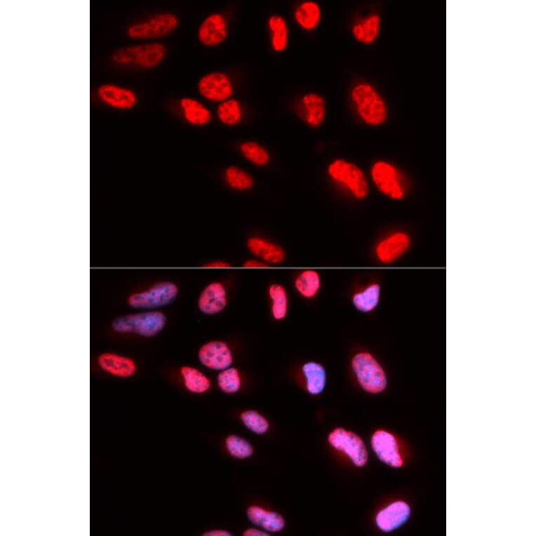 Immunofluorescence - Anti-PRPF3 Antibody (A14795) - Antibodies.com