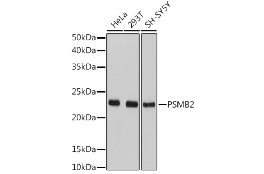 Western Blot - Anti-Proteasome subunit beta type 2/PSMB2 Antibody (A14796) - Antibodies.com