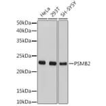 Western Blot - Anti-Proteasome subunit beta type 2/PSMB2 Antibody (A14796) - Antibodies.com