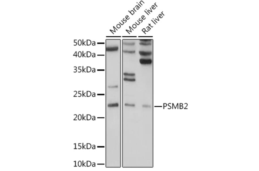 Western Blot - Anti-Proteasome subunit beta type 2/PSMB2 Antibody (A14796) - Antibodies.com