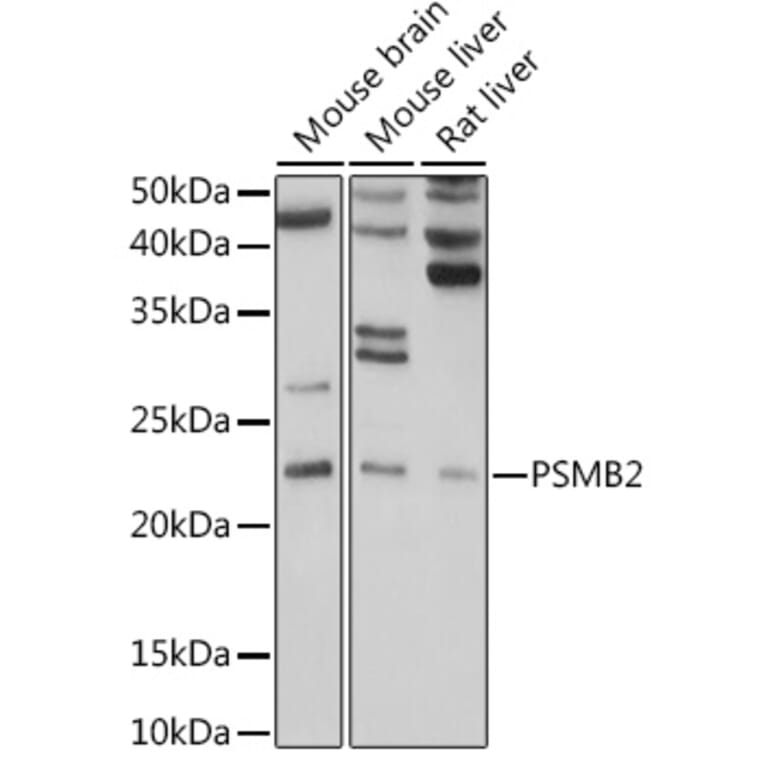 Western Blot - Anti-Proteasome subunit beta type 2/PSMB2 Antibody (A14796) - Antibodies.com