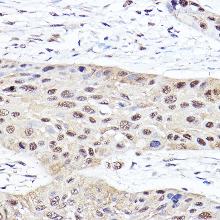 Immunohistochemistry - Anti-Proteasome subunit beta type 2/PSMB2 Antibody (A14796) - Antibodies.com