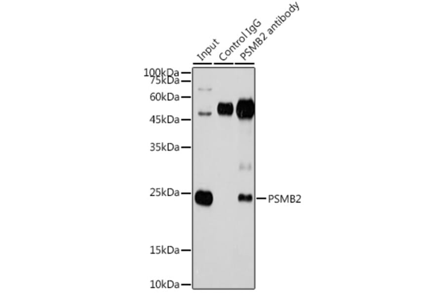 Western Blot - Anti-Proteasome subunit beta type 2/PSMB2 Antibody (A14796) - Antibodies.com