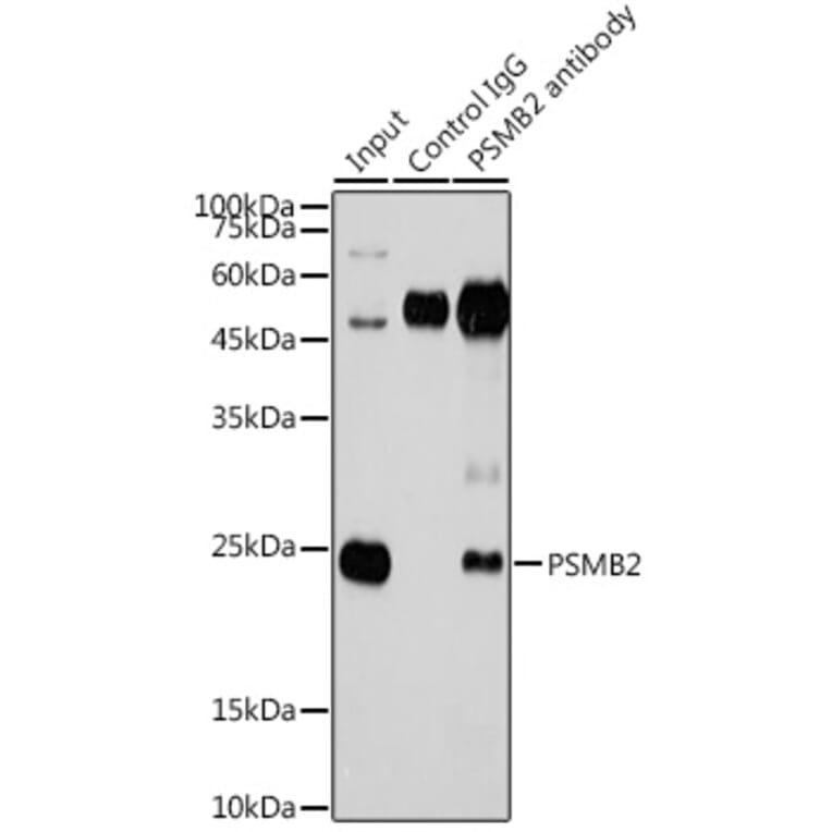 Western Blot - Anti-Proteasome subunit beta type 2/PSMB2 Antibody (A14796) - Antibodies.com