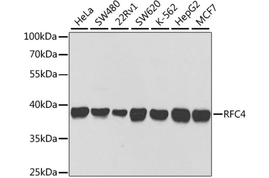 Western Blot - Anti-RFC4 Antibody (A14797) - Antibodies.com