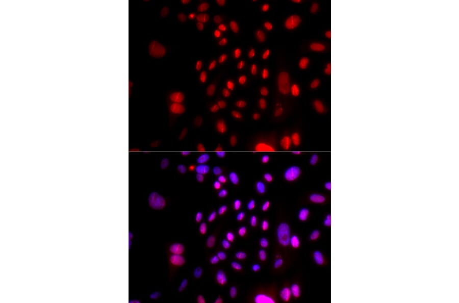 Immunofluorescence - Anti-RFC4 Antibody (A14797) - Antibodies.com