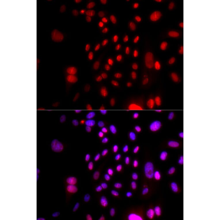 Immunofluorescence - Anti-RFC4 Antibody (A14797) - Antibodies.com