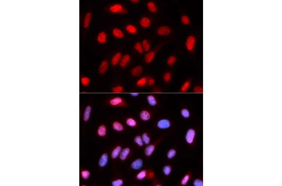 Immunofluorescence - Anti-RFC4 Antibody (A14797) - Antibodies.com
