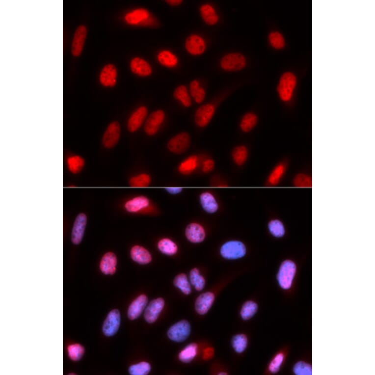 Immunofluorescence - Anti-RFC4 Antibody (A14797) - Antibodies.com