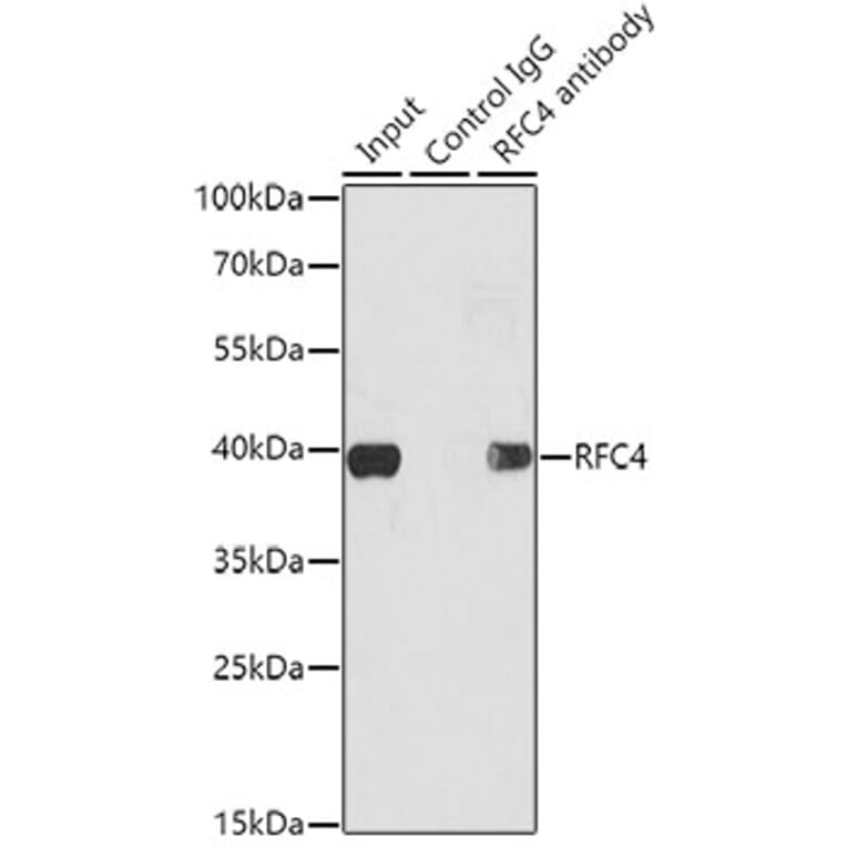 Western Blot - Anti-RFC4 Antibody (A14797) - Antibodies.com