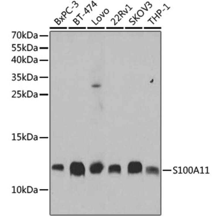 Western Blot - Anti-S100A11 Antibody (A14798) - Antibodies.com