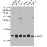 Western Blot - Anti-S100A11 Antibody (A14798) - Antibodies.com