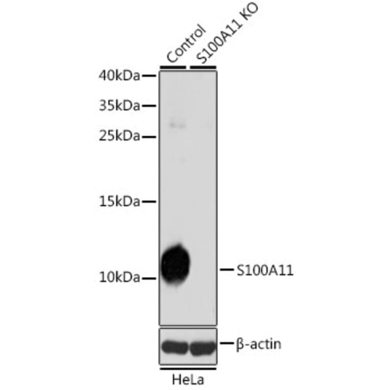 Western Blot - Anti-S100A11 Antibody (A14798) - Antibodies.com