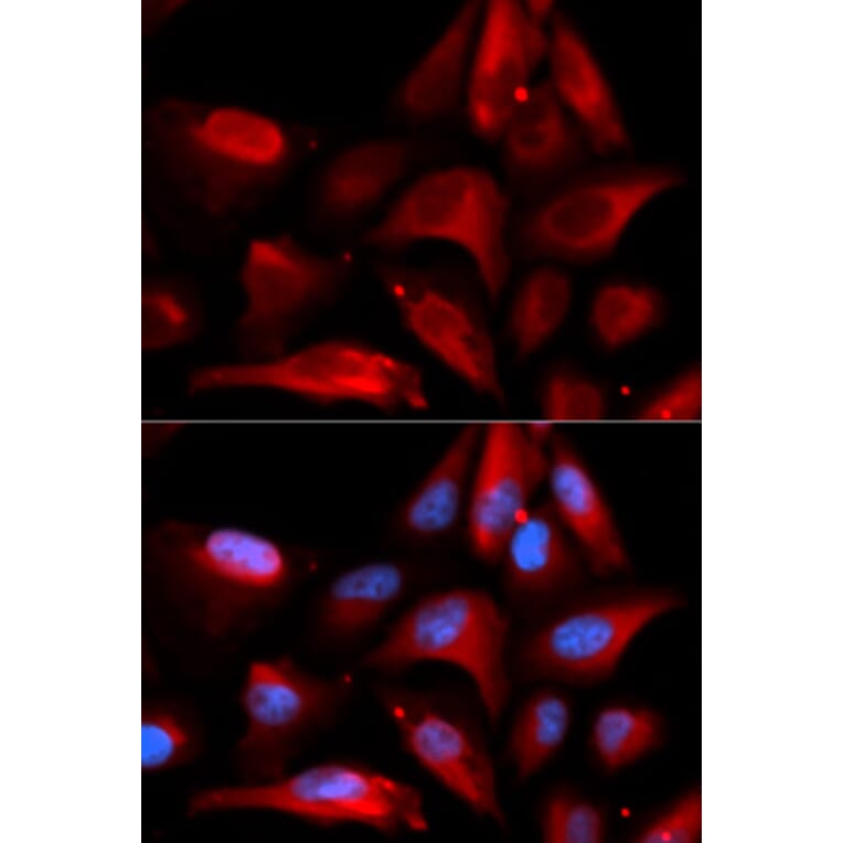 Immunofluorescence - Anti-S100A11 Antibody (A14798) - Antibodies.com