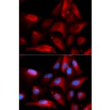 Immunofluorescence - Anti-S100A11 Antibody (A14798) - Antibodies.com