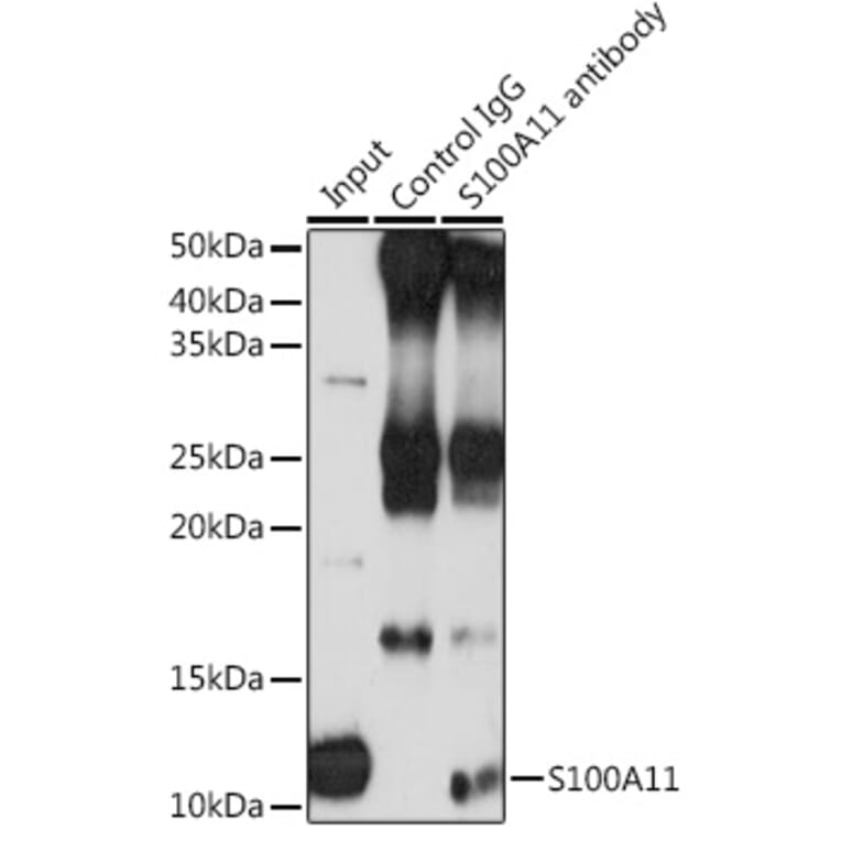 Western Blot - Anti-S100A11 Antibody (A14798) - Antibodies.com