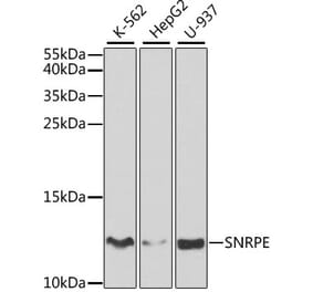 Western Blot - Anti-Sm-E Antibody (A14799) - Antibodies.com