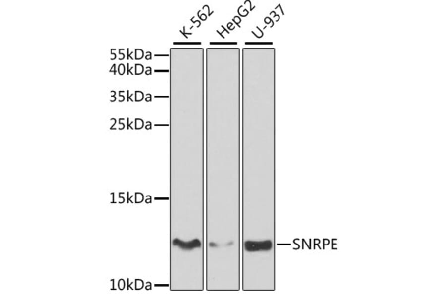 Western Blot - Anti-Sm-E Antibody (A14799) - Antibodies.com