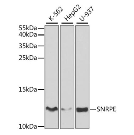 Western Blot - Anti-Sm-E Antibody (A14799) - Antibodies.com
