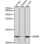Western Blot - Anti-Sm-E Antibody (A14799) - Antibodies.com