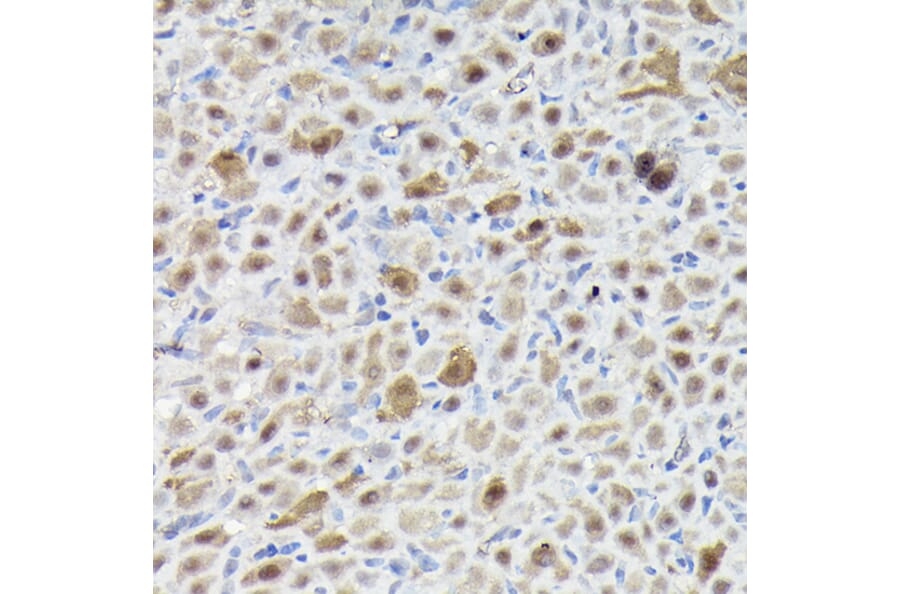 Immunohistochemistry - Anti-Sm-E Antibody (A14799) - Antibodies.com