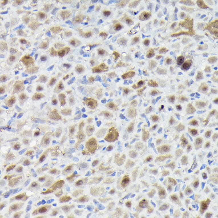 Immunohistochemistry - Anti-Sm-E Antibody (A14799) - Antibodies.com