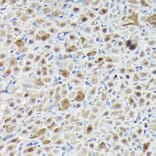 Immunohistochemistry - Anti-Sm-E Antibody (A14799) - Antibodies.com