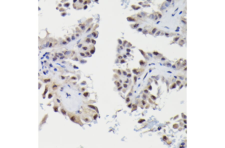 Immunohistochemistry - Anti-Sm-E Antibody (A14799) - Antibodies.com