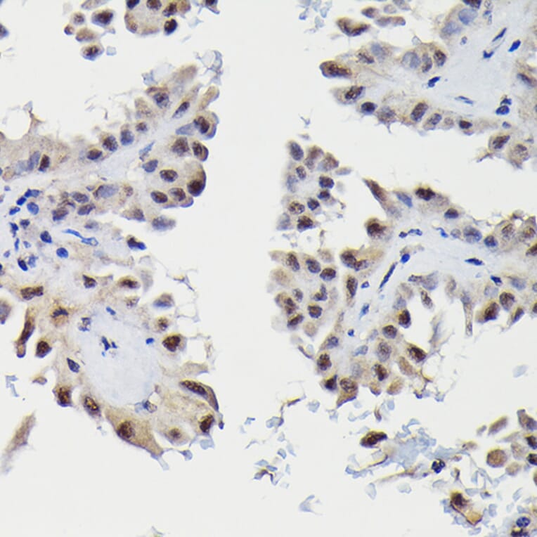 Immunohistochemistry - Anti-Sm-E Antibody (A14799) - Antibodies.com