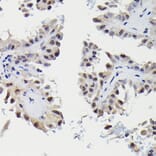 Immunohistochemistry - Anti-Sm-E Antibody (A14799) - Antibodies.com