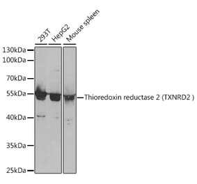Western Blot - Anti-TXNRD2 Antibody (A14800) - Antibodies.com