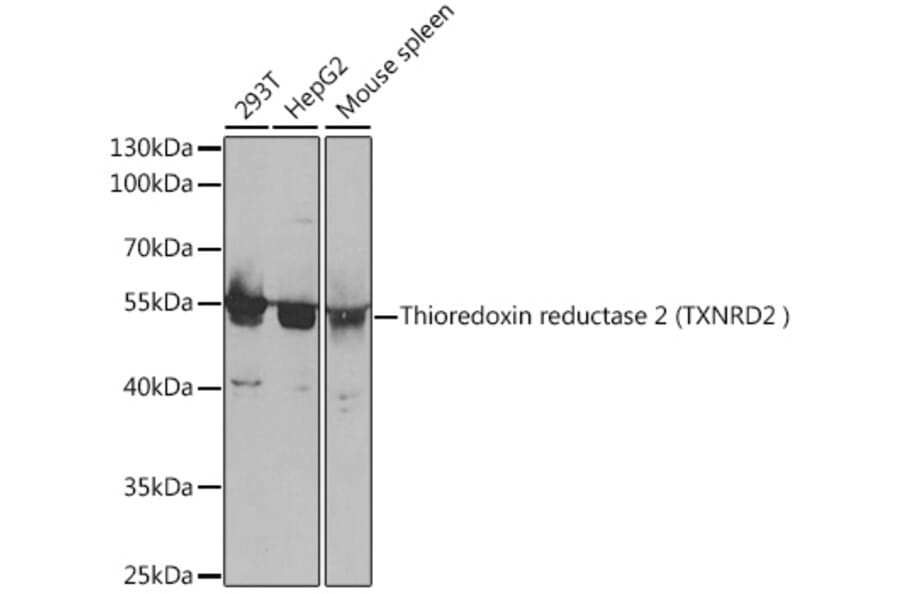 Western Blot - Anti-TXNRD2 Antibody (A14800) - Antibodies.com