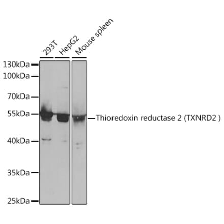 Western Blot - Anti-TXNRD2 Antibody (A14800) - Antibodies.com