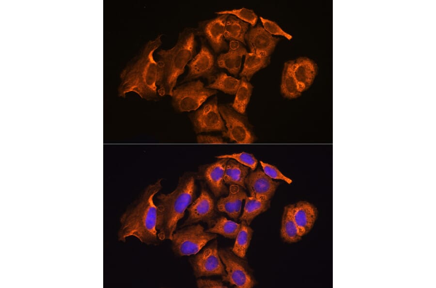 Immunofluorescence - Anti-TXNRD2 Antibody (A14800) - Antibodies.com
