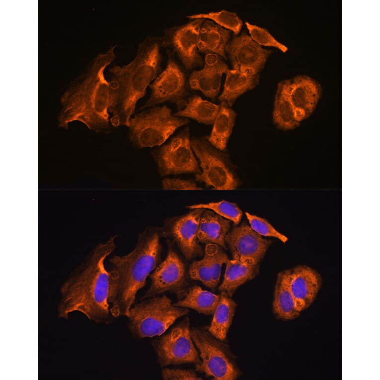 Immunofluorescence - Anti-TXNRD2 Antibody (A14800) - Antibodies.com