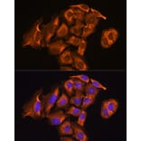 Immunofluorescence - Anti-TXNRD2 Antibody (A14800) - Antibodies.com
