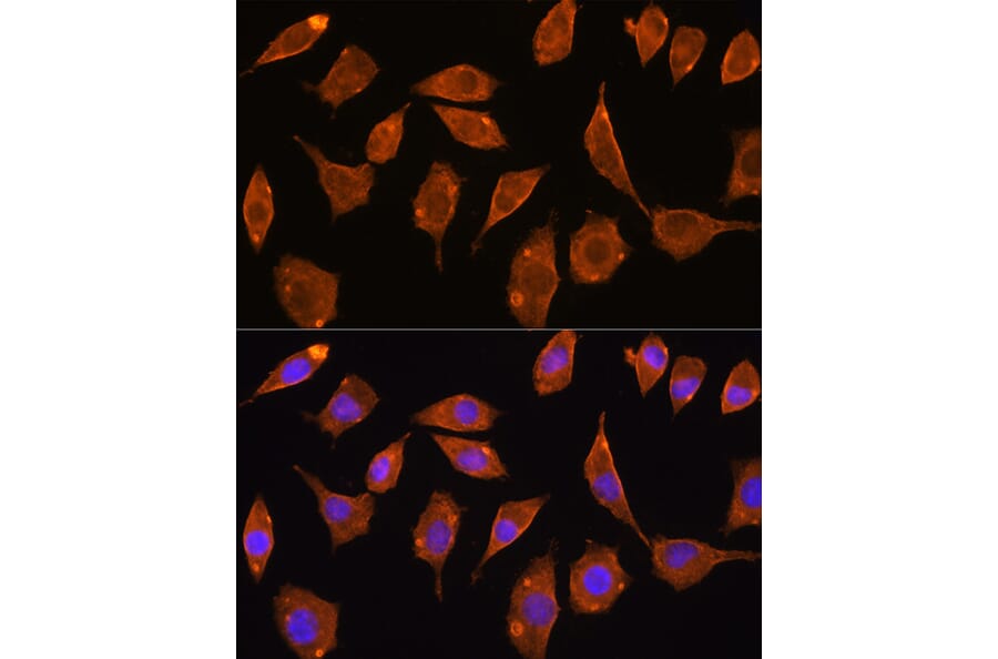 Immunofluorescence - Anti-TXNRD2 Antibody (A14800) - Antibodies.com