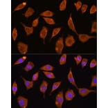 Immunofluorescence - Anti-TXNRD2 Antibody (A14800) - Antibodies.com