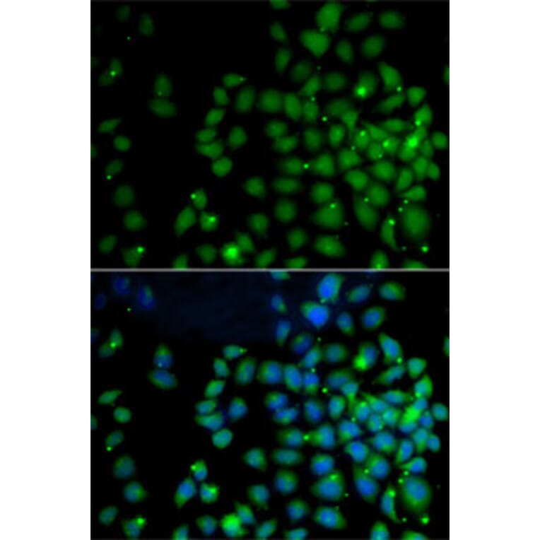 Immunofluorescence - Anti-FAT10 Antibody (A14801) - Antibodies.com