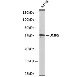 Western Blot - Anti-OPRT Antibody (A14802) - Antibodies.com