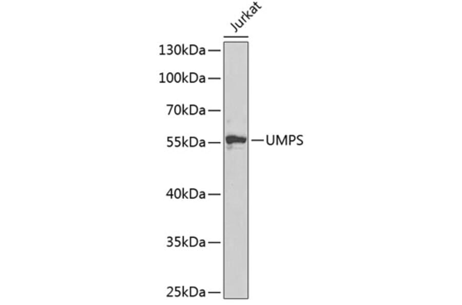 Western Blot - Anti-OPRT Antibody (A14802) - Antibodies.com