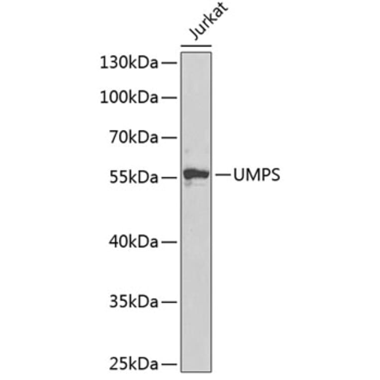 Western Blot - Anti-OPRT Antibody (A14802) - Antibodies.com