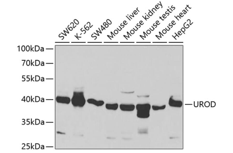 Western Blot - Anti-UPD Antibody (A14803) - Antibodies.com