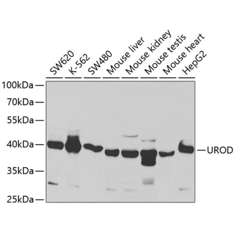 Western Blot - Anti-UPD Antibody (A14803) - Antibodies.com