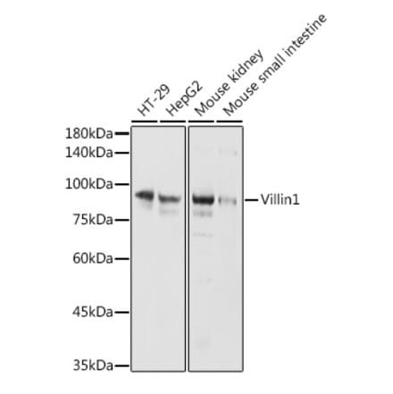 Western Blot - Anti-Villin Antibody (A14804) - Antibodies.com